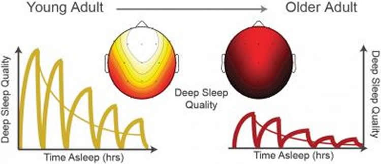 Image shows the neural activity during sleep.