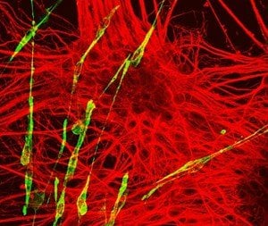 Image shows neurons and muscle cells.