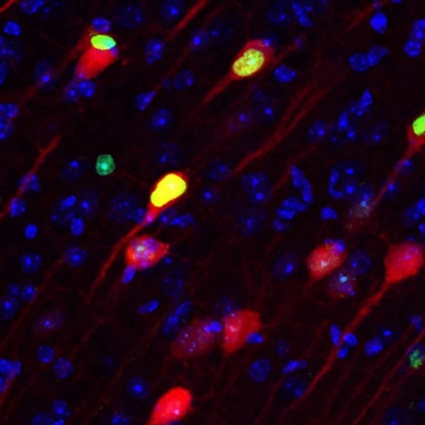 Image shows memory engram cells.
