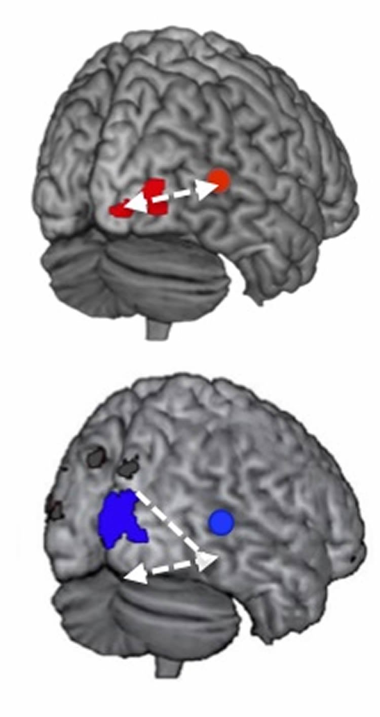 Image shows the areas of the brain and cochlear implant outcome