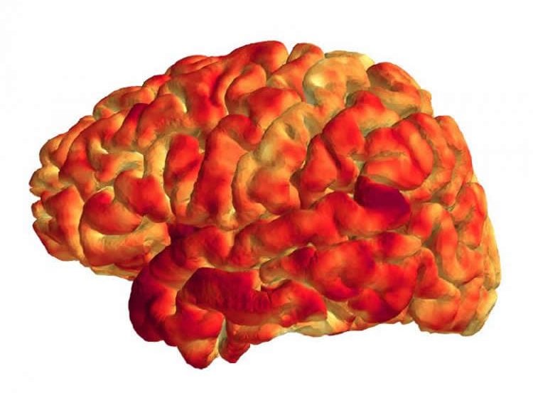 Image shows the cerebral cortex.