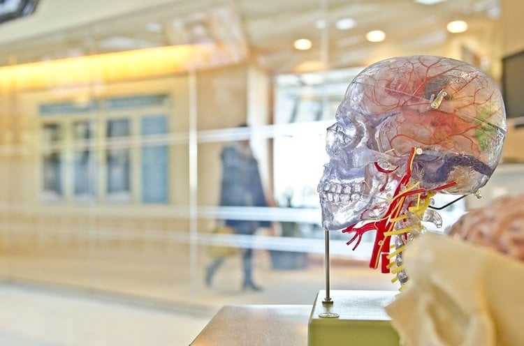 Image shows a statue of a brain.