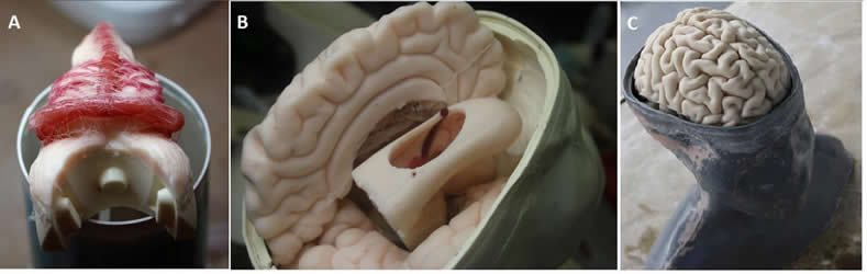 Image shows the brain model.
