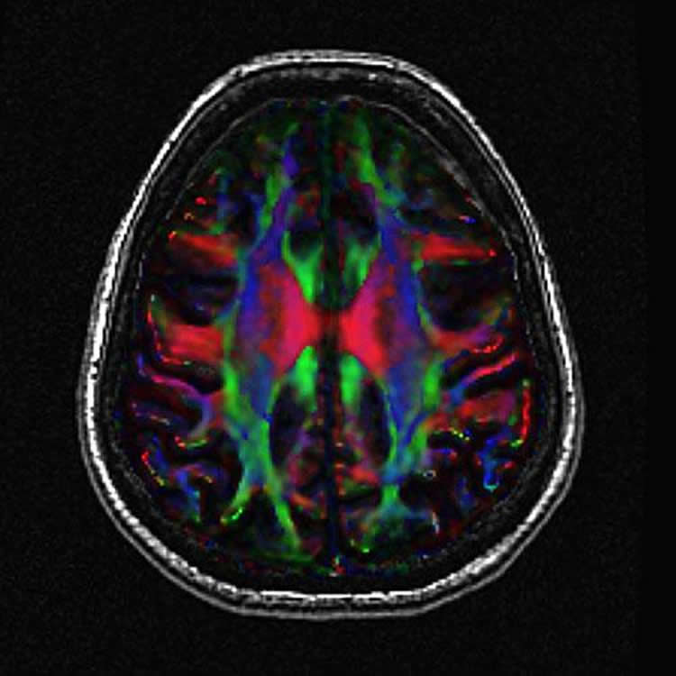 a brain scan.