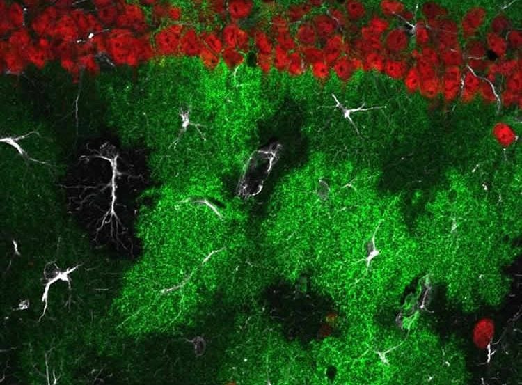 Image shows astrocytes and neurons.