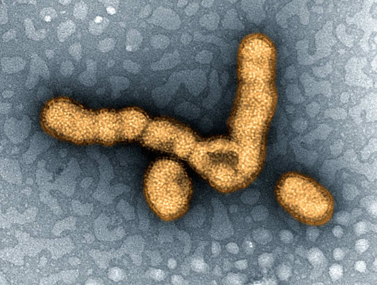 Image shows the H1N1 virus.