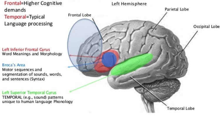 Image shows language areas in the brain.