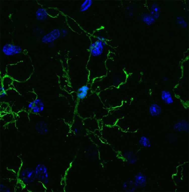 Image shows microglia.