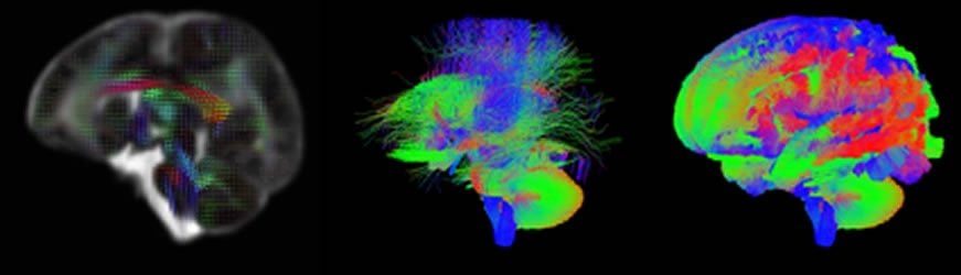 Image shows neonatal brain scans.