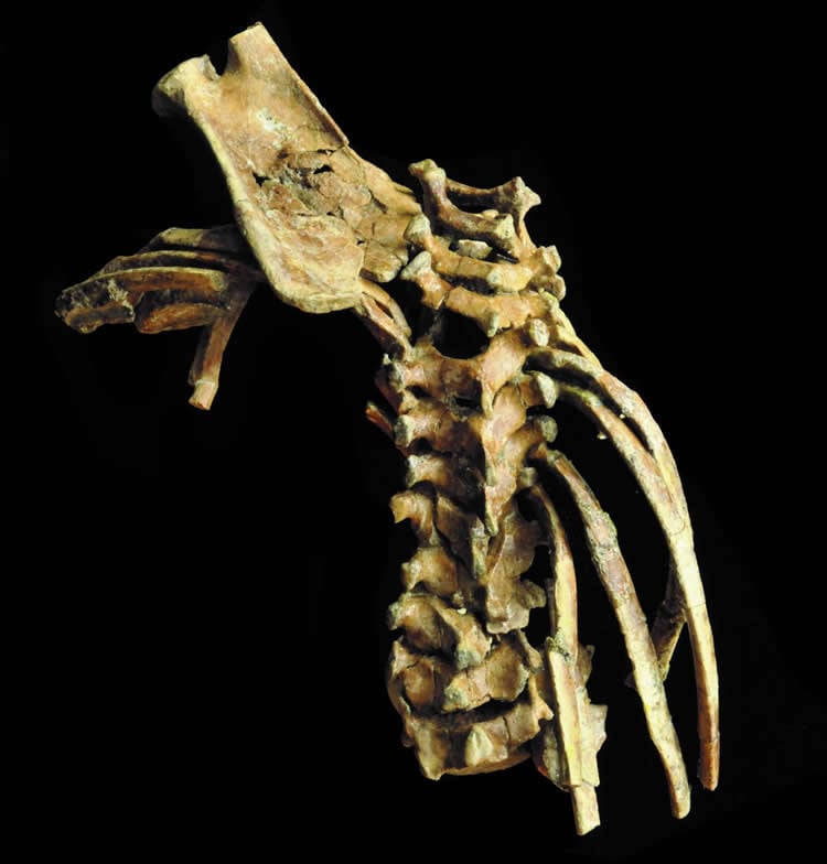 Image shows the spine.