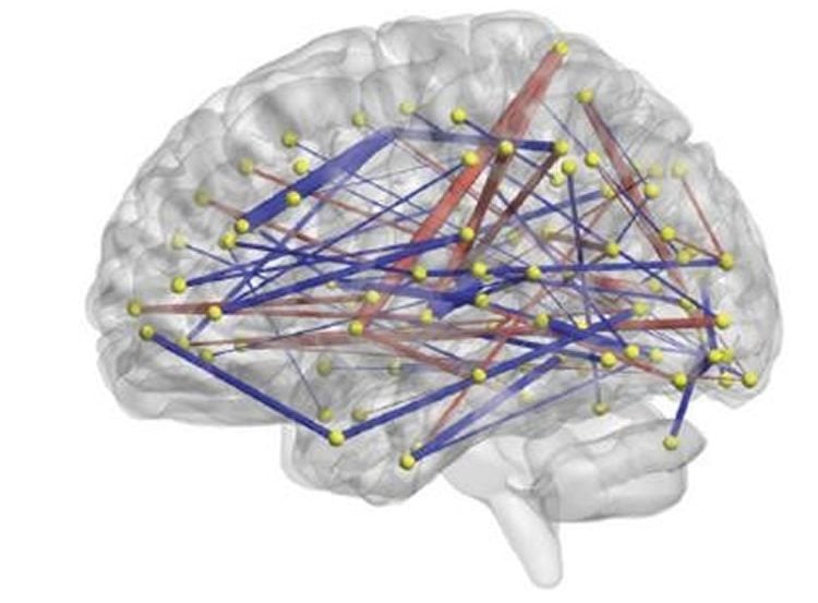 Image shows a brain with lines to represent a network.