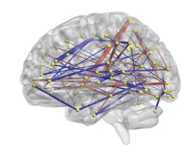 Image shows a brain with lines to represent a network.