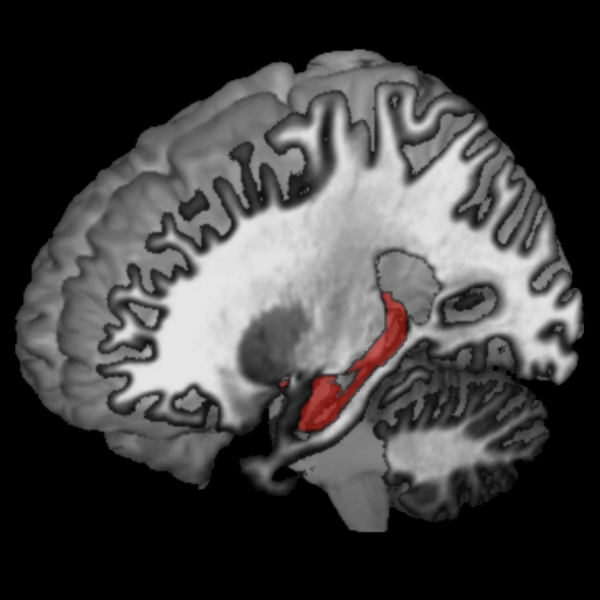 the hippocampus is shown