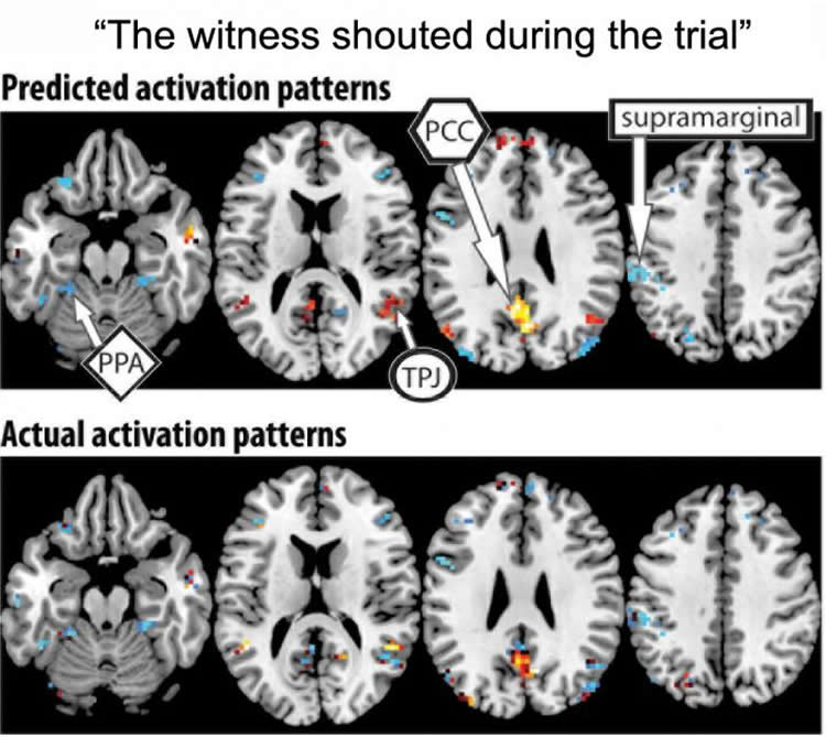 Image shows a brain.