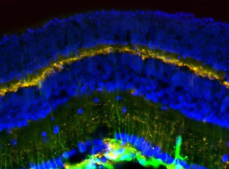 Image shows glial cells in a mouse retina.