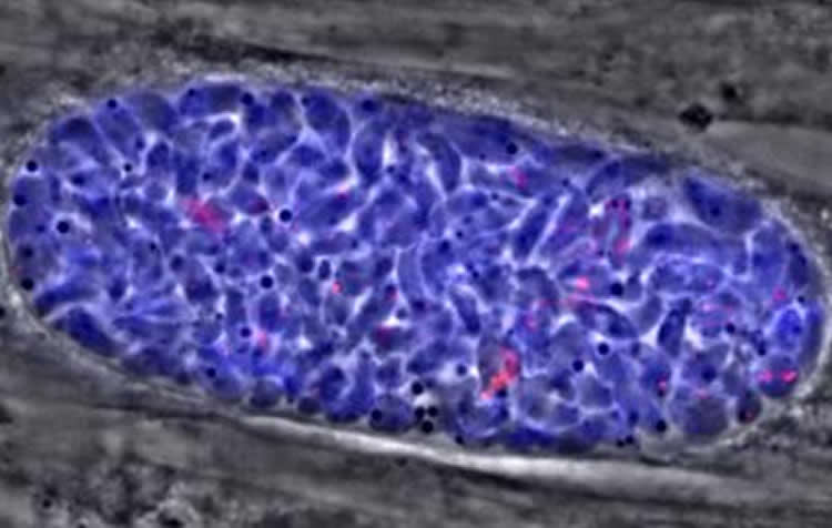 Image shows a Toxoplasma tissue cyst.