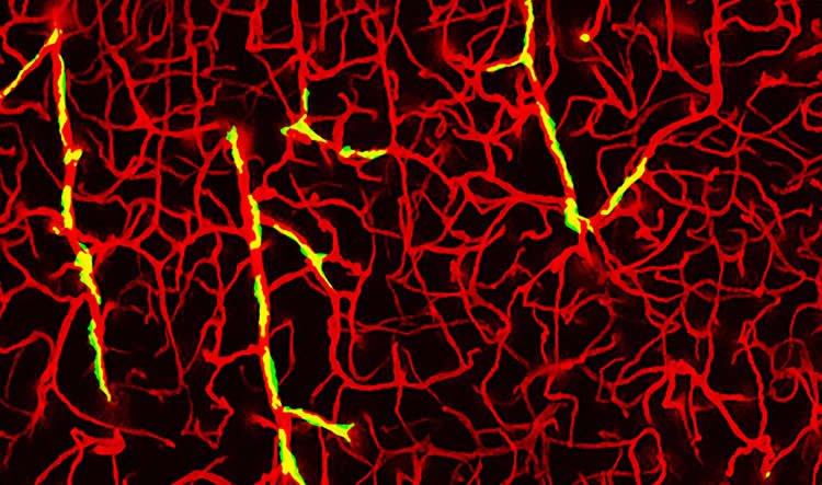 Image shows immune cells and blood vessels in the brain.