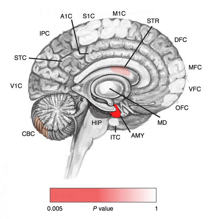 Image shows a brain with the amygdala highlighted in red.