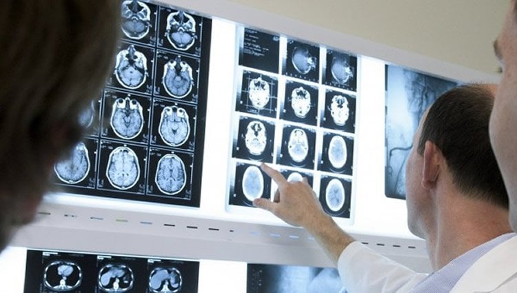 Image shows a doctor looking at brain scans.