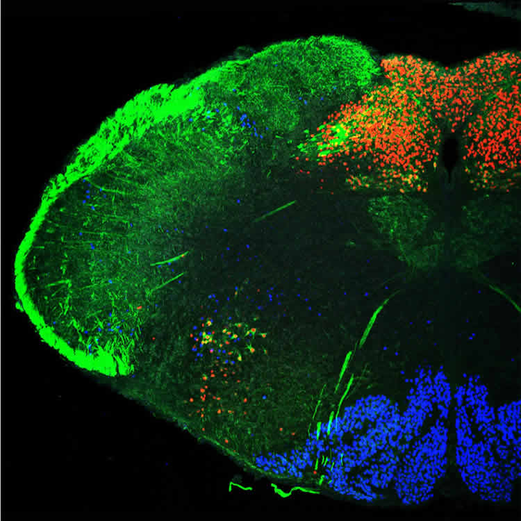 Image shows a mouse hindbrain.