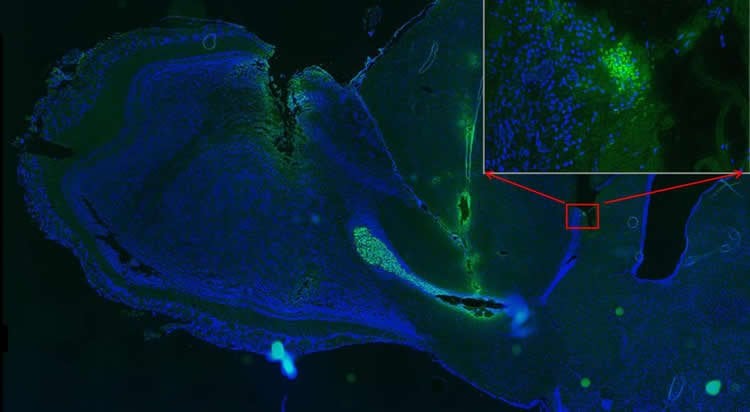 Image shows transplanted neural stem cells.