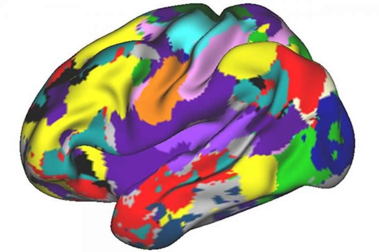 Image shows a brain scan of one of the researchers.