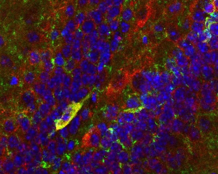 Image shows CCK neurons.