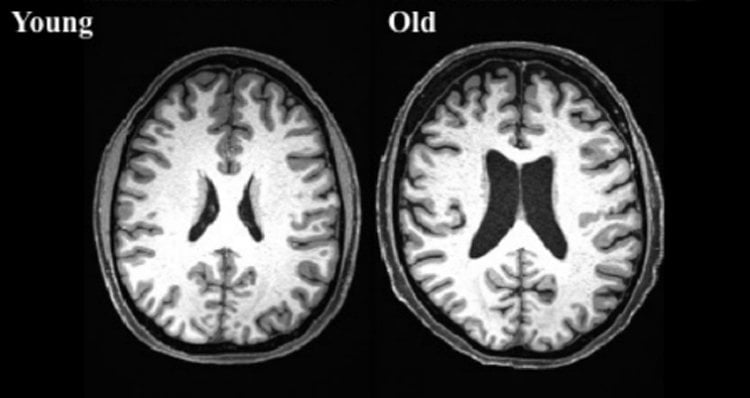 brain scans.