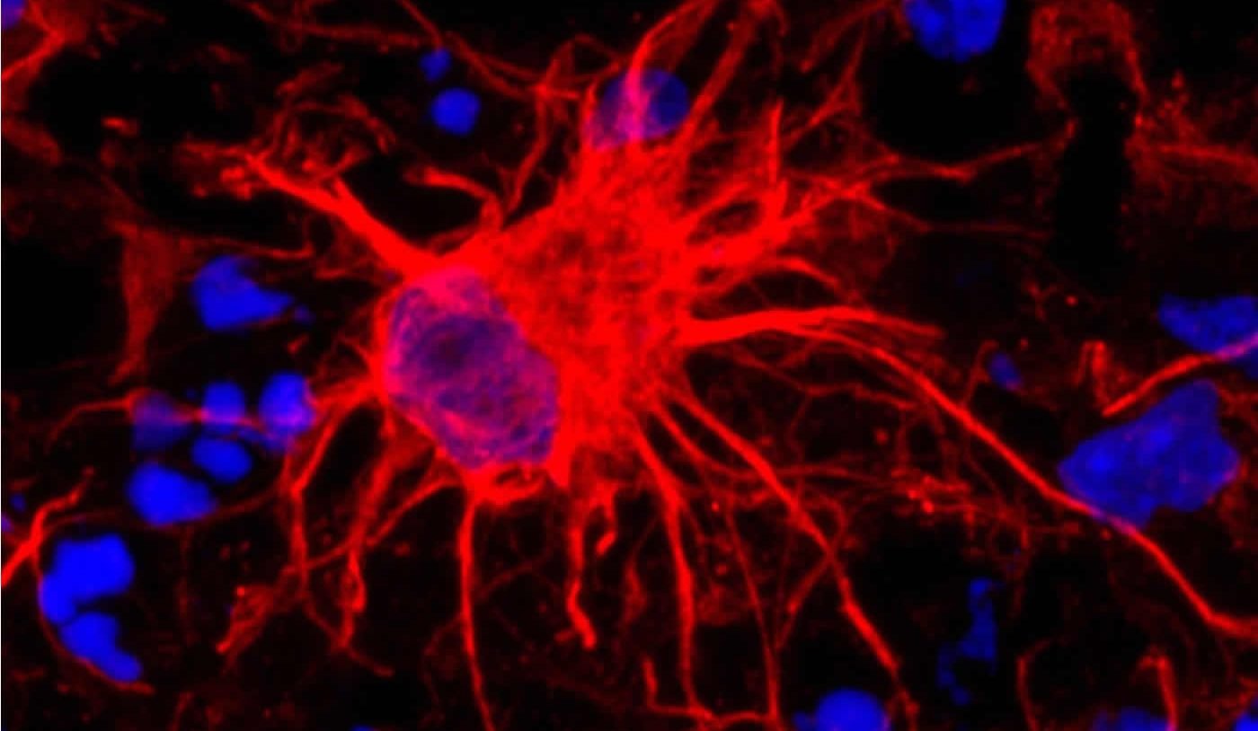 Image shows an astrocyte.