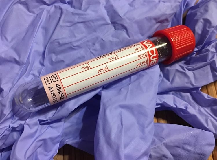 Image shows a blood sample.