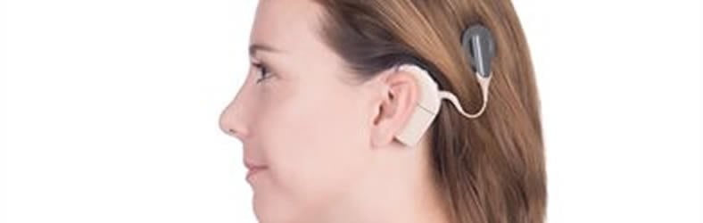 Image shows a woman with a cochlear implant.