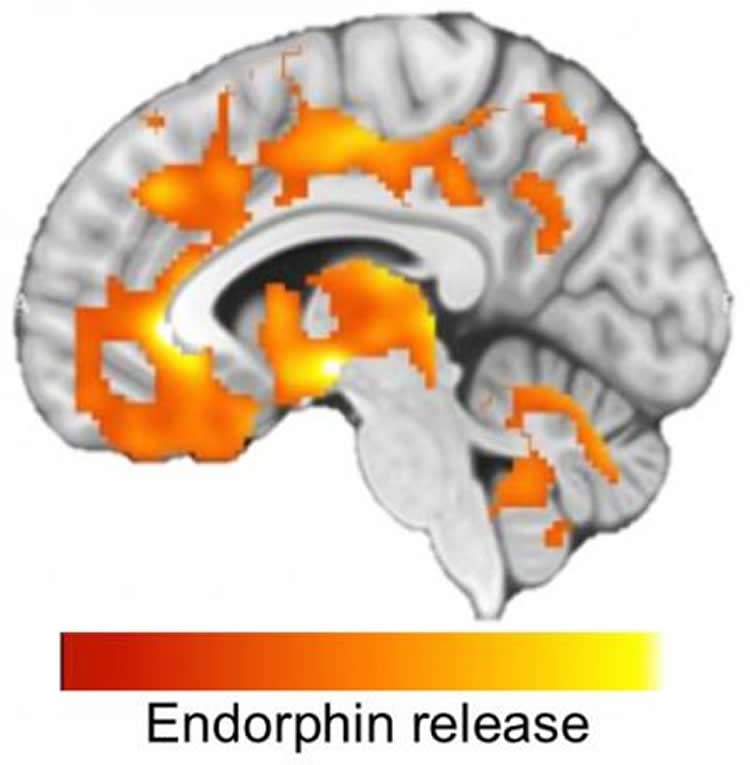 Image shows endorphin release in a brain scan.