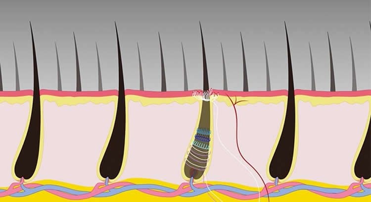 Image shows hair follicles.