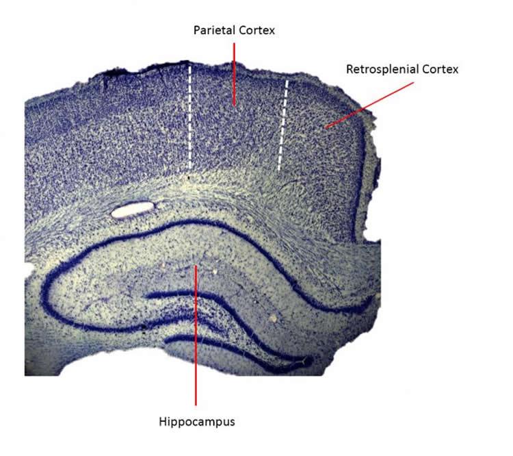 Image shows the location of the retrosplenial cortex in the brain.