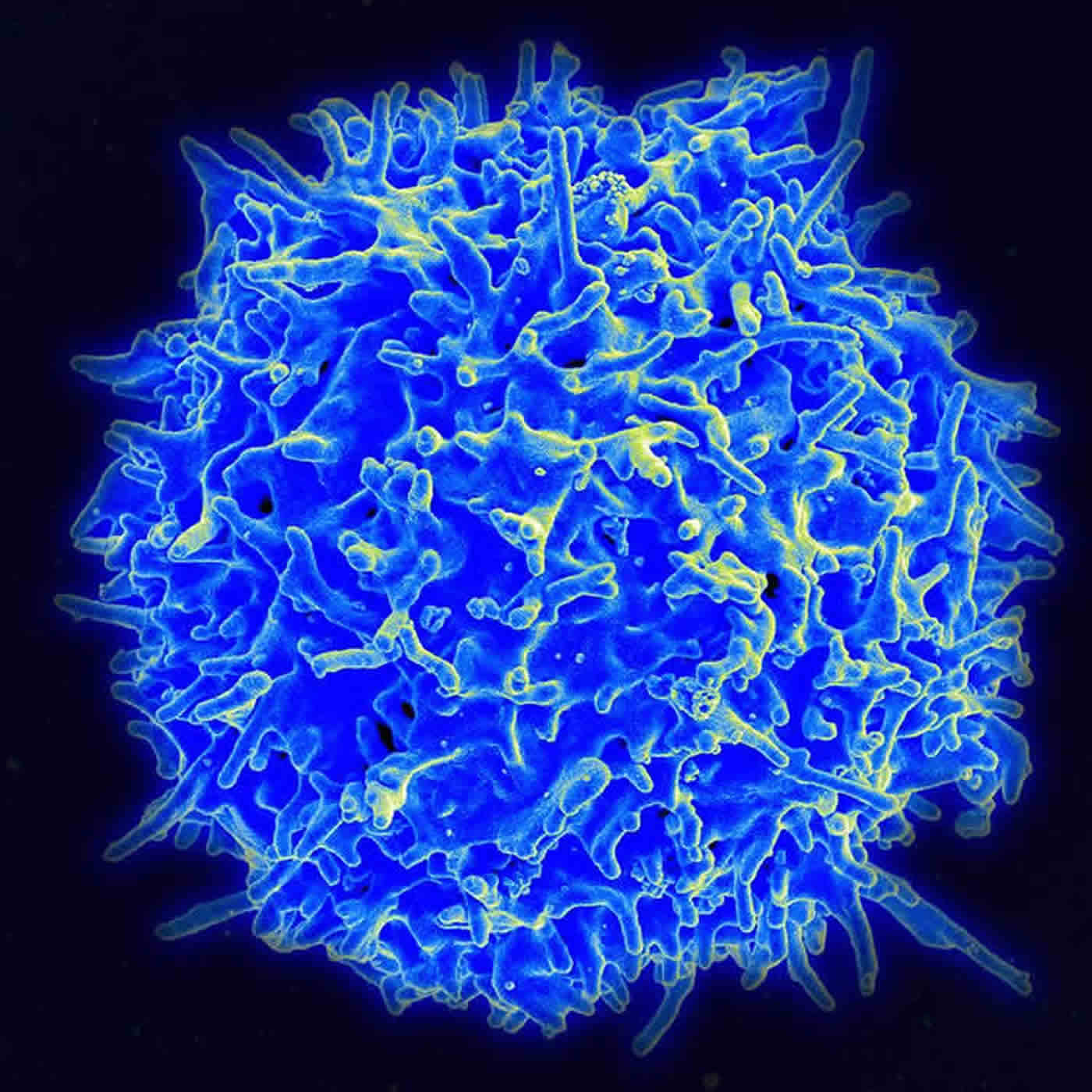  Image shows a T cell.