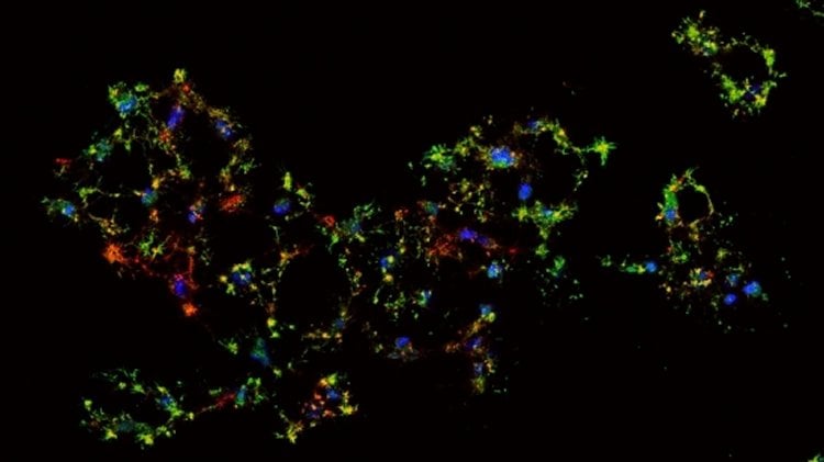 Image shows dying cancer cells.