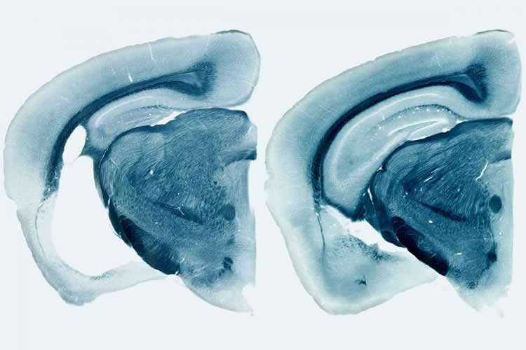 Image shows brain slices.
