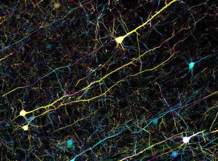 This image shows Confocal microscopy of mouse brain cells.