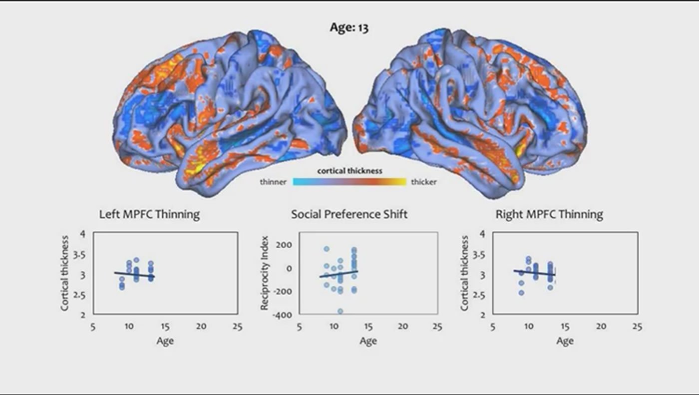 Image shows the brain structural changes at age 13.