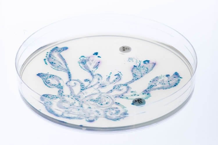 Image shows gut bacteria on a petri dish.