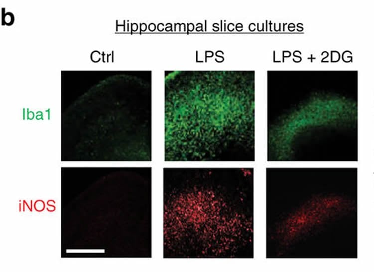 This image shows hippocampal slices.