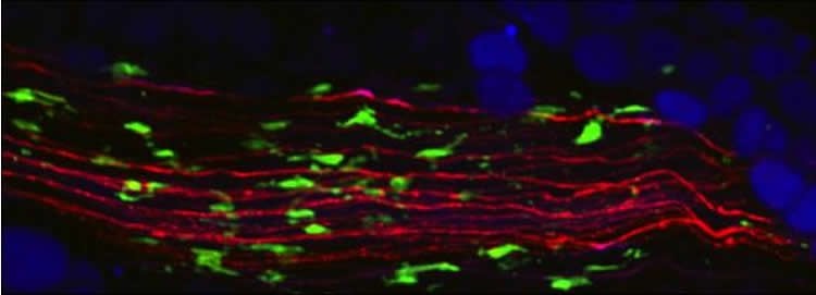 Image shows macrophages and neurons.