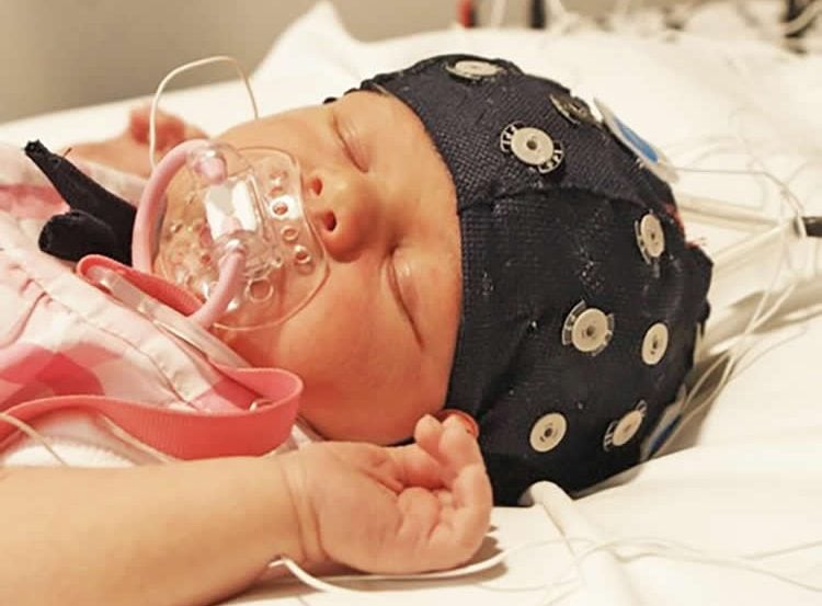 Image shows a baby in an eeg cap.