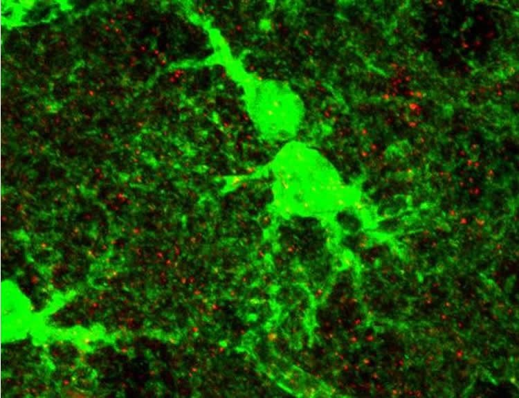 Image shows astrocytes.