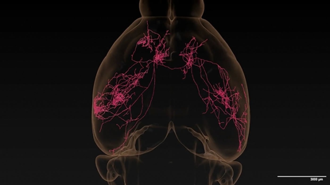 axon tracing