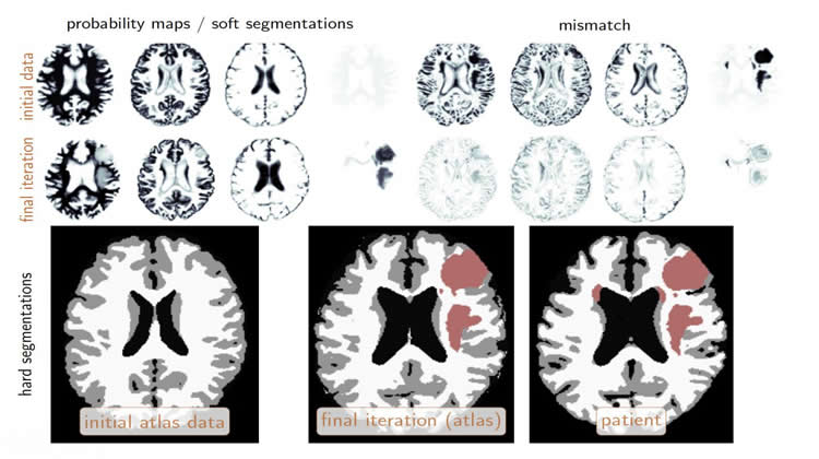 Image shows brain images.