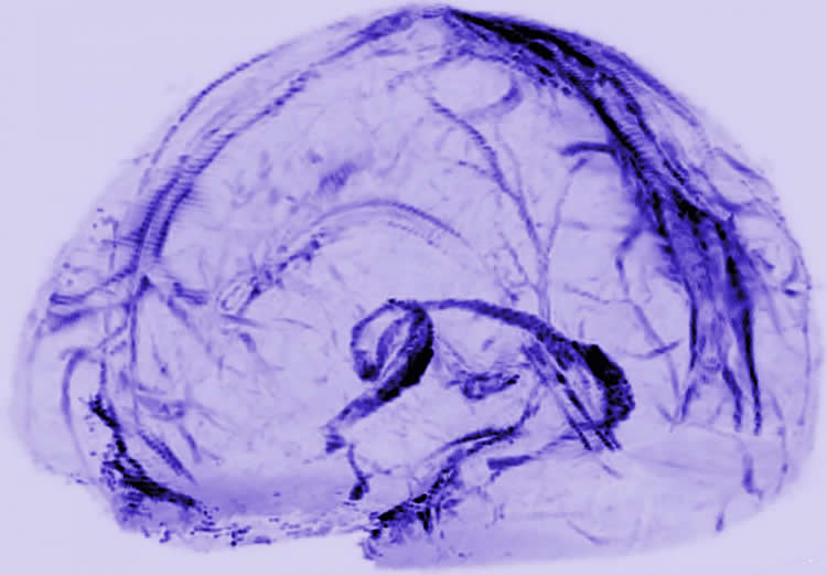 Image shows lymphatic vessels in the brain.