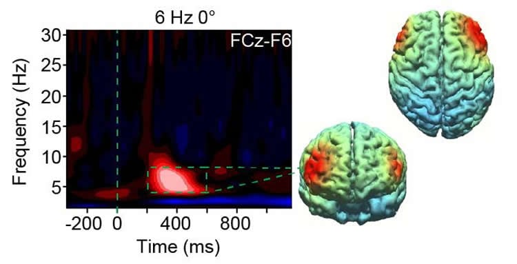 a brain scan