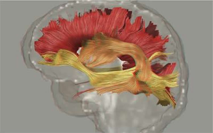 Image shows fiber pathways in the brain.