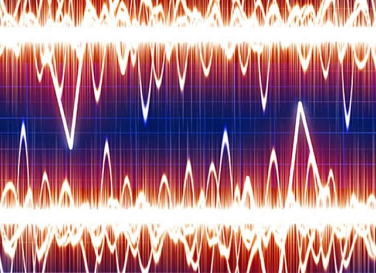 Image shows brain waves.